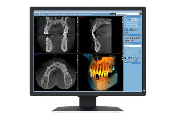 Monitor Eizo 21" MX217-SB - imagine 10